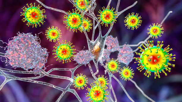 Infectious etiology of dementia. Viruses that affect neurons stock photo