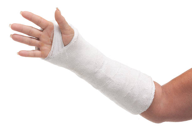 Top 60 Fracture Bandage Human Hand Plaster Stock Photos, Pictures, and ...