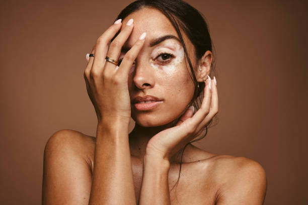 Insecurities of women due to skin problems Portrait of young woman with vitiligo on brown background. Close up of woman with skin condition covering her face with hand. imperfection stock pictures, royalty-free photos & images