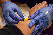 Gloved nurse using a butterfly setup to insert a hypodermic needle into a superficial vein on a patient’s arm in preparation for an intravenous infusion.