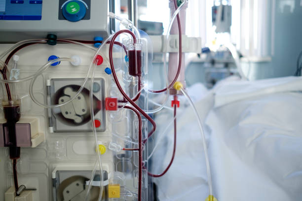 intensive care emergency room with hemodialysis machine (or hemofiltration procedure), patient in critical stance stock photo