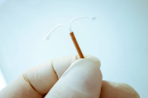 Intrauterine device (IUD) stock photo
