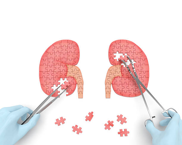 Kidneys operation Kidneys operation puzzle concept: hands of surgeon with surgical instruments (tools) performs kidney surgery as a result of renal failure (nephrism), urinary stone disease, urosepsis, kidney cyst cyst photos stock pictures, royalty-free photos & images