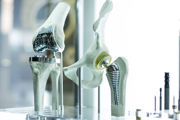 Knee and hip prosthesis for medicine Modern knee and hip prosthesis made by cad engineer and manufactured by 3d printing human knee stock pictures, royalty-free photos & images