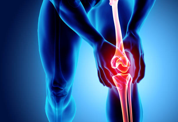Knee painful - skeleton x-ray. Knee painful - skeleton x-ray, 3D Illustration medical concept. joint pain stock pictures, royalty-free photos & images
