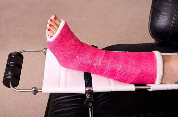 Lady with Fractured Leg A lady with a fractured leg sat in an armchair with her pink pot on a raised leg support human toe stock pictures, royalty-free photos & images