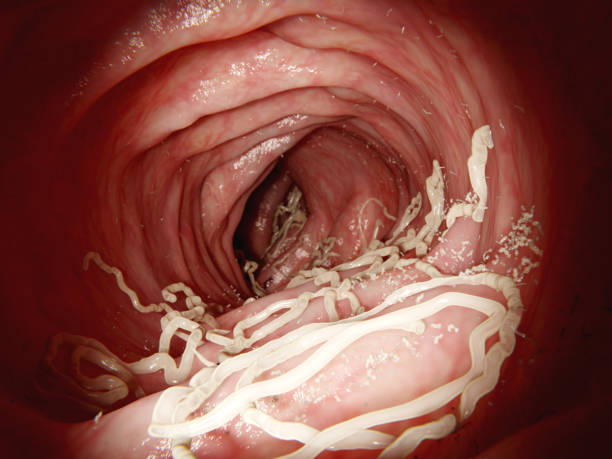 Large roundworm in human intestine The large roundworm (A. lumbricoides) lives in the intestines where it lays eggs. The larvae penetrate the intestine wall entering the blood stream and infestating several organs. About 1 billion people are infected worldwide with this parasite. nematode worm stock pictures, royalty-free photos & images
