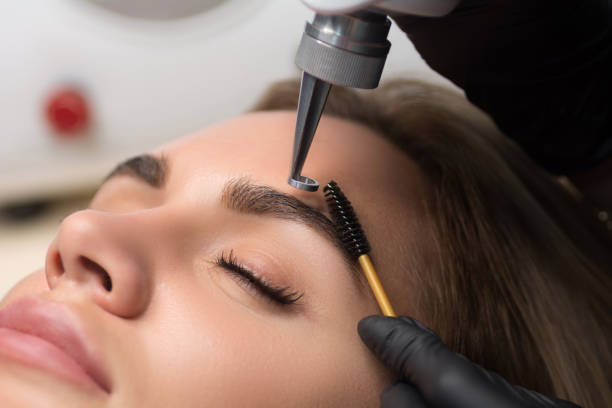 Laser removal of permanent makeup. The beautician removes the tattoo from the eyebrows stock photo