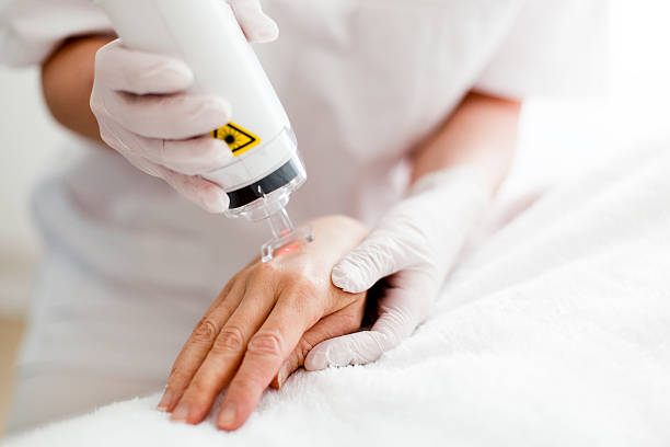 Laser Skin Resurfacing Photo of a patient getting Laser Skin treatment. laser stock pictures, royalty-free photos & images