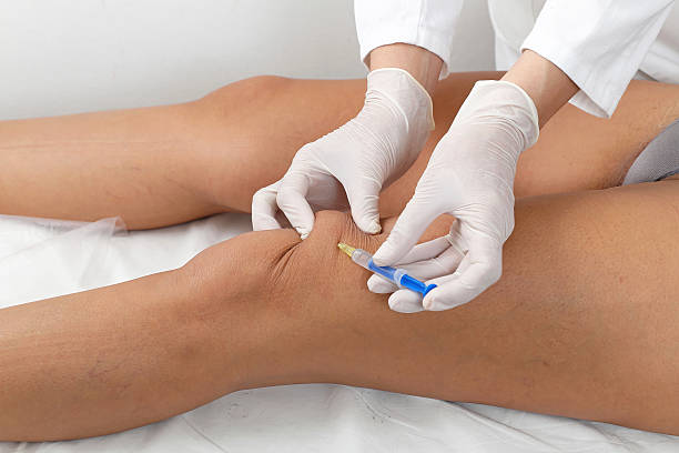 Leg botox Woman having botox treatment at beauty clinic human knee stock pictures, royalty-free photos & images