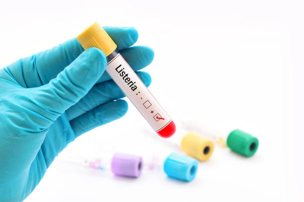 Listeria positive Blood sample tube positive with Listeria bacteria listeria stock pictures, royalty-free photos & images