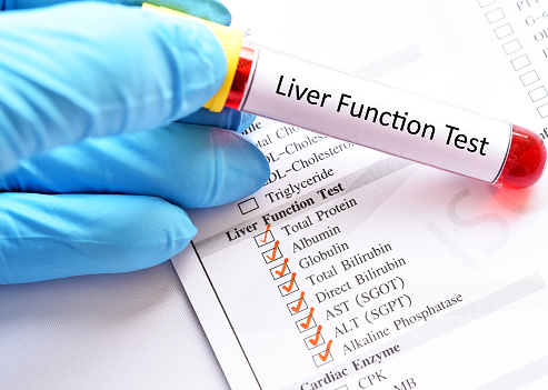 liver function test picture id954737560?b=1&k=20&m=954737560&s=170667a&w=0&h=LqAl