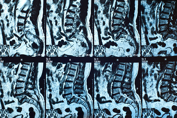 Low back MRI scan stock photo
