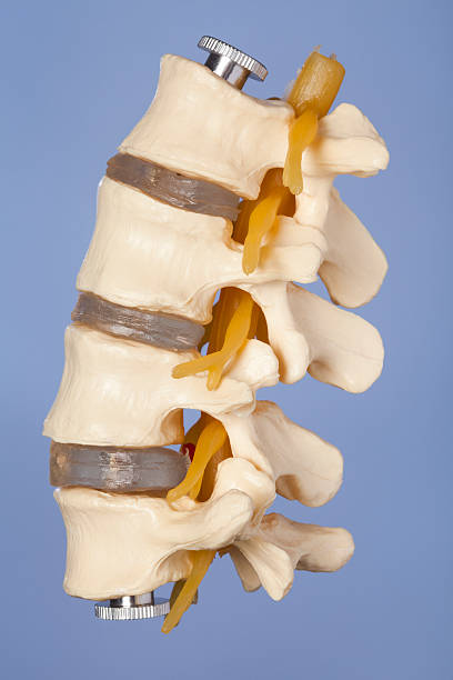 Lumbar vertebrae Lumbar vertebrae shows with one herniated disc and two normal discs. Blue background. cauda equina photos stock pictures, royalty-free photos & images