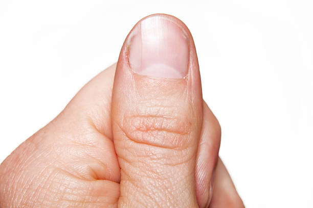 macro close-up thumb finger stock photo