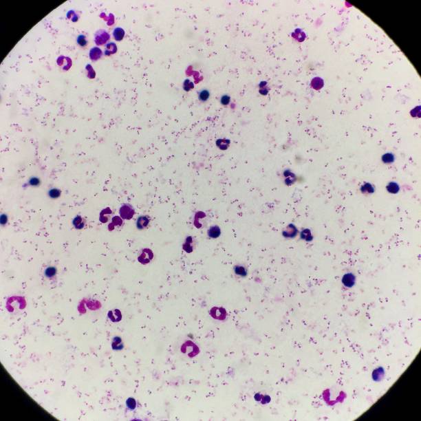 malariaparasieten gezien door een microscoop - malaria stockfoto's en -beelden