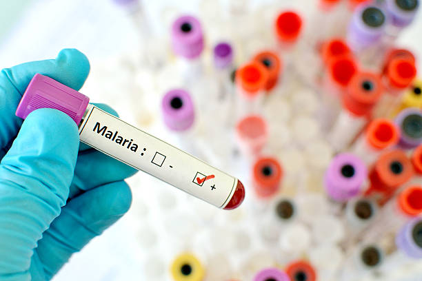 Malaria positive Blood sample with malaria parasite positive malaria parasite stock pictures, royalty-free photos & images