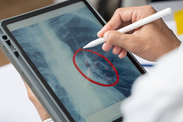 A male Asian doctor is writing a X-Ray summary of coronavirus patients on a tablet at the hospital. A male Asian doctor is writing a X-Ray summary of coronavirus patients on a tablet at the hospital. medical x ray stock pictures, royalty-free photos & images