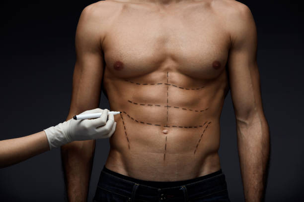 Human Body. Closeup Of Man's Fit Body With Abs, Muscular Torso And...