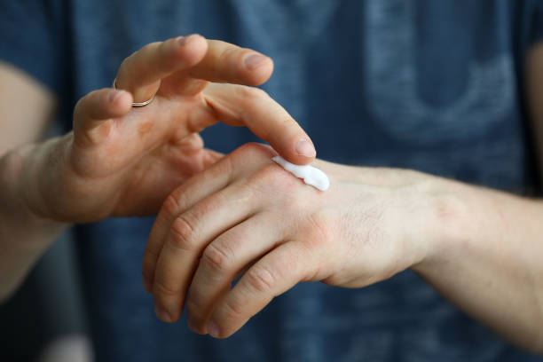 Male hands applying moistening cream on skin stock photo