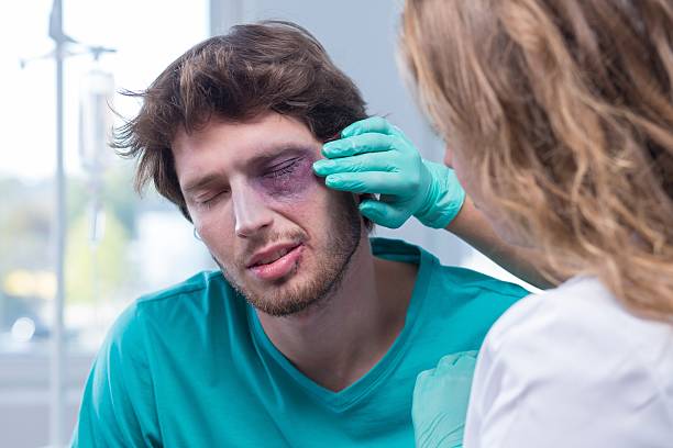 Male patient with black eye Portrait of male patient with black eye black eye stock pictures, royalty-free photos & images