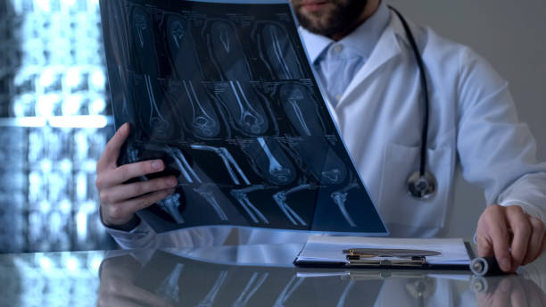 Male traumatologist looking at patient leg x-ray, diagnostic health problem stock photo