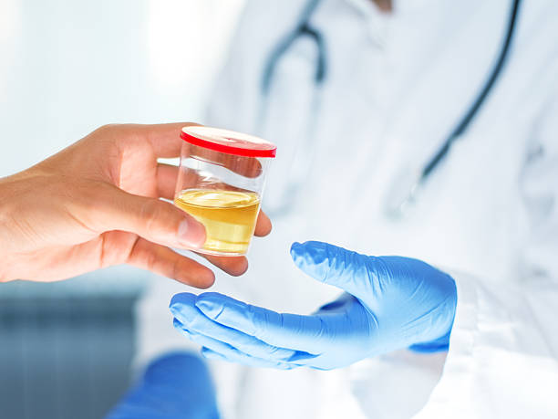 Man handing container with urine sample to a doctor stock photo