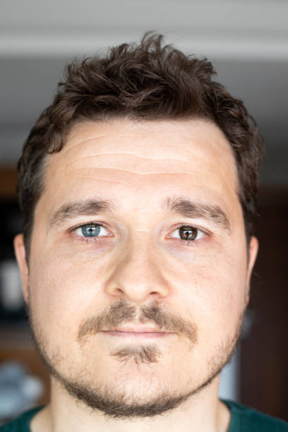 Man has two diffrent colored eyes- heterochromia Man has two diffrent colored eyes- heterochromia iridium stock pictures, royalty-free photos & images