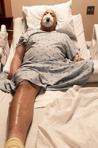 病院のベッドで眠っている人工呼吸器足切断者コロナウイルス癌血栓を身に着けている 四肢切断のストックフォトや画像を多数ご用意 Istock