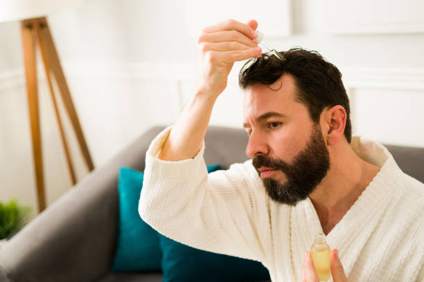 Man in his 30s losing his hair stock photo