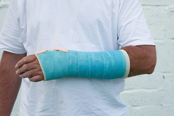 Man With A Broken Wrist stock photo