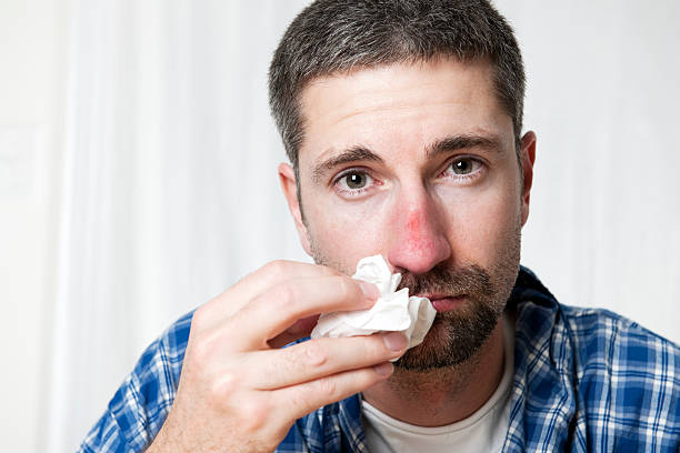 Man with Cold/Flu Series  clown's nose stock pictures, royalty-free photos & images