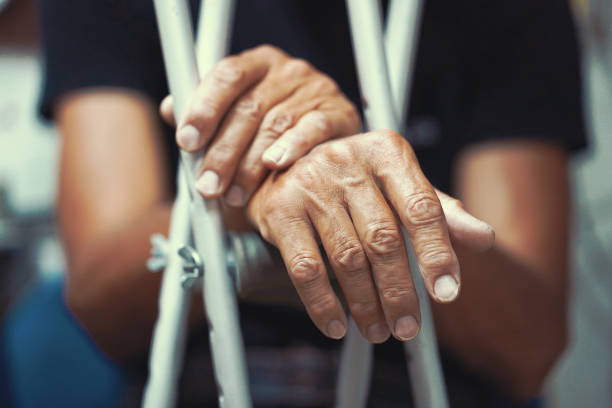 Man with crutch. Close-up. Side view Hands of old man on crutches. Close-up a elderly man with crutches. physical injury stock pictures, royalty-free photos & images