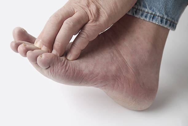 man with itchy toes stock photo