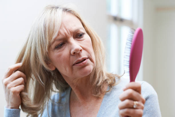 Mature Woman With Brush Corncerned About Hair Loss stock photo
