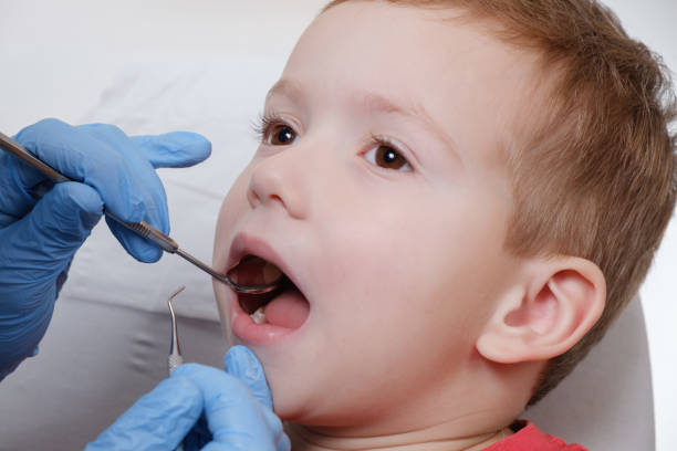 Medical examination of child patient teeth using a mirror by a dentist. Caries, tooth damage. Medical examination of child patient teeth using a mirror of instruments by a dentist. Caries, tooth close up damage, illness. rotten teeth in children stock pictures, royalty-free photos & images