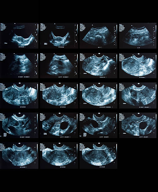 Medical exams. Pelvic ultrasound ovary photos stock pictures, royalty-free photos & images