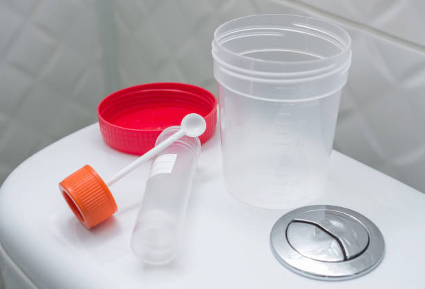 Medical kit for the sampling of feces and empty urine sample cup. Medical laboratory tests, concept. Medical kit for the sampling of feces and empty urine sample cup. Medical laboratory tests, concept. medical sample stock pictures, royalty-free photos & images