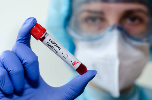 Medical laboratory assistant holding test tube with positive Omicron COVID-19 test blood sample. stock photo
