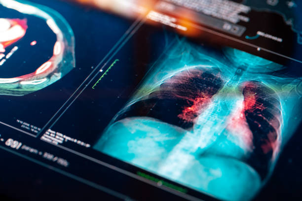 medische mri-scan - longen stockfoto's en -beelden