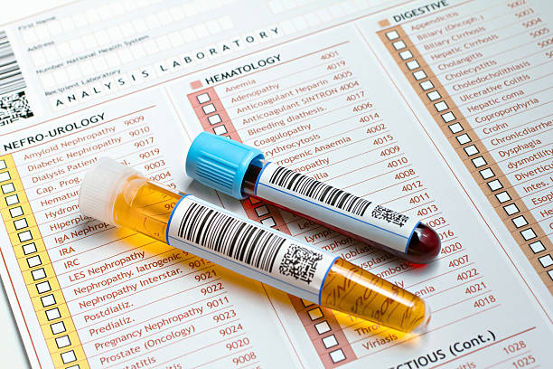 medical report with tubes of blood and urine "Two tubes labeled with bar codes, each urine sample and one with blood on a medical report for a routine analysis" medical sample stock pictures, royalty-free photos & images