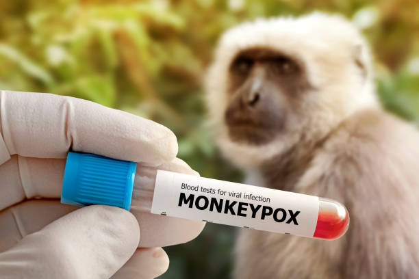 한 의료진이 원숭이두 바이러스에 감염된 혈액 샘플을 손에 들고 장갑을 끼고 클로즈업한 채 시험관을 들고 있습니다. 유럽과 미국에서 천연두 원숭이의 전염병. - monkey pox 뉴스 사진 이미지