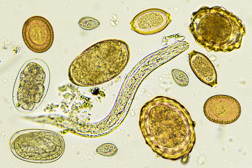 organisme helmintice parazite