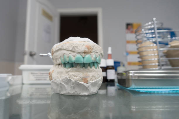 modeling of artificial teeth on a plaster model stock photo