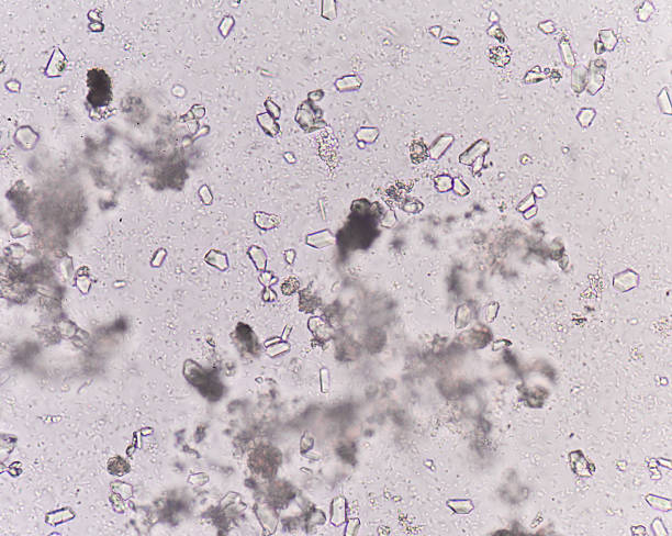 White particles in urine early pregnancy