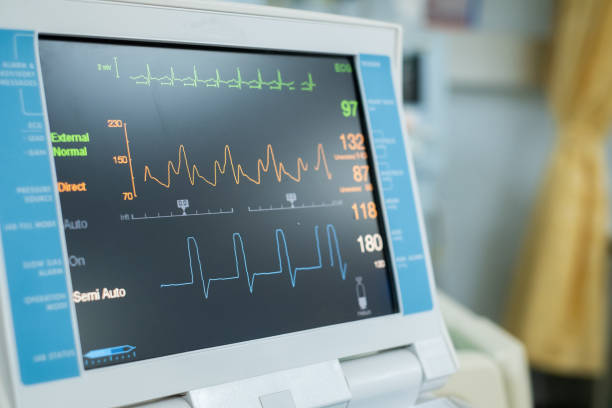EKG monitor in intra aortic balloon pump machine. Medical equipment stock photo