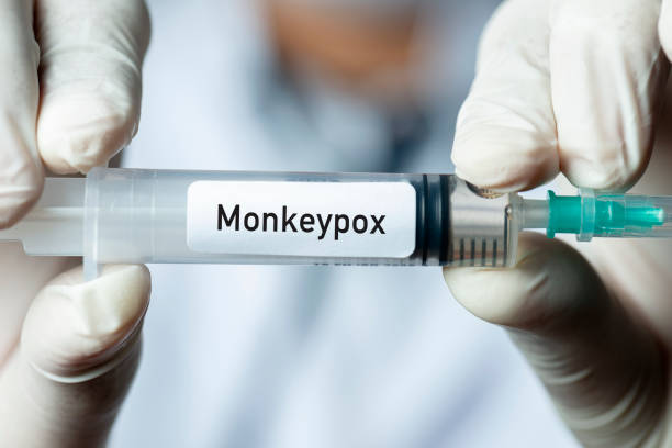 Monkeypox Male doctor holding monkeypox vaccine. monkeypox stock pictures, royalty-free photos & images