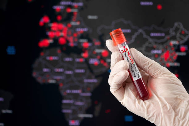 monkeypox positive blood tube and world pandemic map - monkeypox stok fotoğraflar ve resimler
