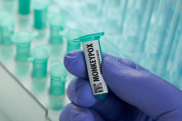 Monkeypox virus in laboratory vials and test tubes stock photo