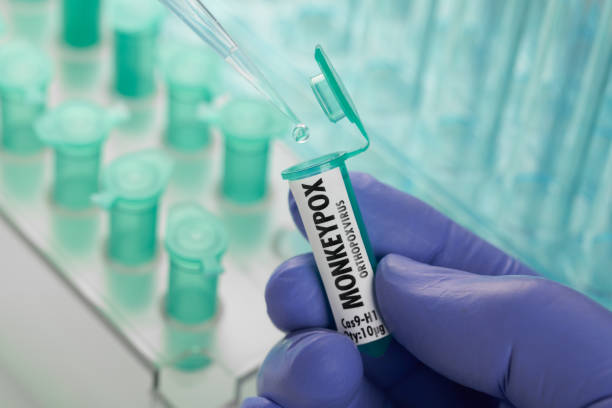 monkeypox virus in laboratory vials. pipette and test tubes - monkeypox stockfoto's en -beelden